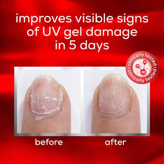 essie nail care-to the rescue benefits